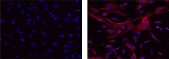 Mouse IgG1 kappa Isotype Control in Immunocytochemistry (ICC/IF)