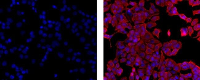 Mouse IgG1 kappa Isotype Control in Immunocytochemistry (ICC/IF)