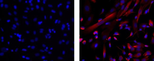 Mouse IgG1 kappa Isotype Control in Immunocytochemistry (ICC/IF)