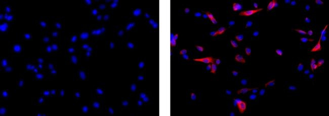 Mouse IgG1 kappa Isotype Control in Immunocytochemistry (ICC/IF)