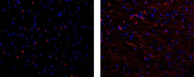 Mouse IgG1 kappa Isotype Control in Immunohistochemistry (Paraffin) (IHC (P))