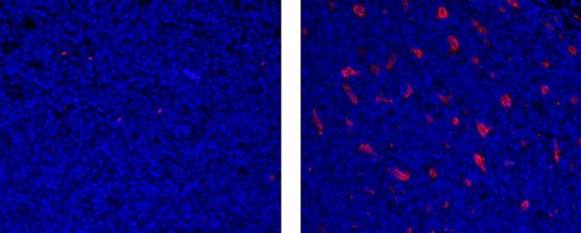 Mouse IgG1 kappa Isotype Control in Immunohistochemistry (Paraffin) (IHC (P))