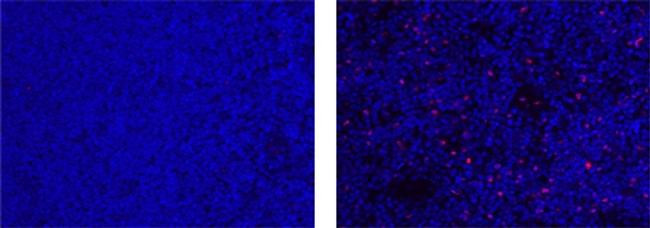 Mouse IgG1 kappa Isotype Control in Immunohistochemistry (Paraffin) (IHC (P))