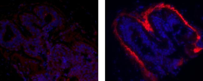 Mouse IgG1 kappa Isotype Control in Immunohistochemistry (Paraffin) (IHC (P))