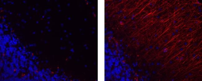 Mouse IgG1 kappa Isotype Control in Immunohistochemistry (Paraffin) (IHC (P))