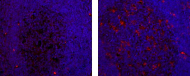 Mouse IgG2b kappa Isotype Control in Immunohistochemistry (Paraffin) (IHC (P))