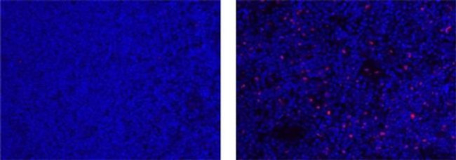 FOXP3 Antibody in Immunohistochemistry (Paraffin) (IHC (P))