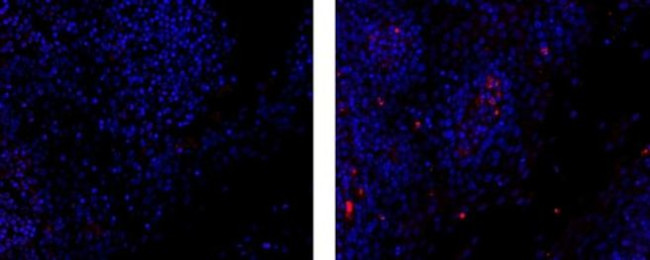 Rat IgG2b Secondary Antibody in Immunohistochemistry (Paraffin) (IHC (P))