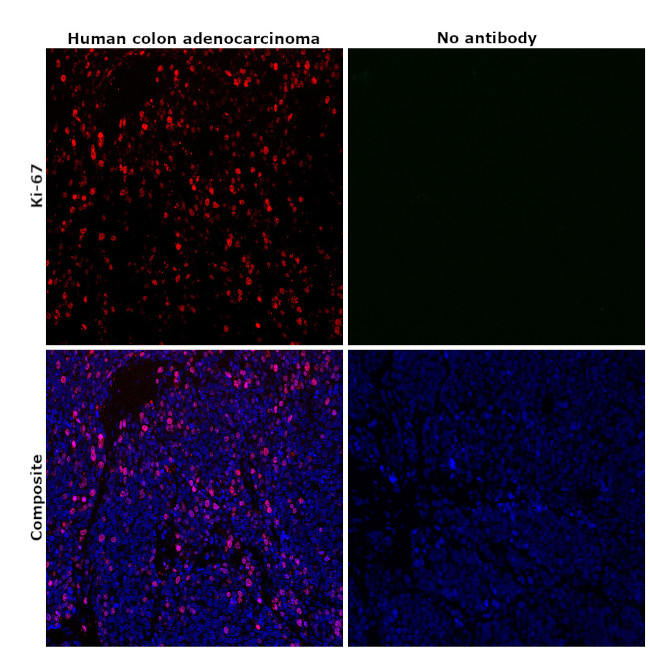 Ki-67 Antibody in Immunohistochemistry (Paraffin) (IHC (P))