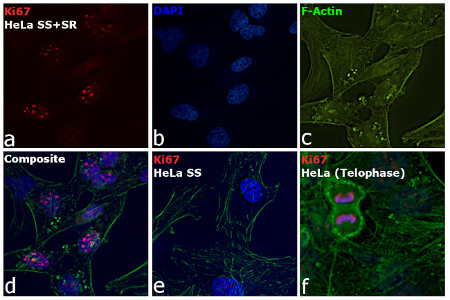 Ki-67 Antibody