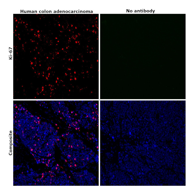 Ki-67 Antibody in Immunohistochemistry (Paraffin) (IHC (P))