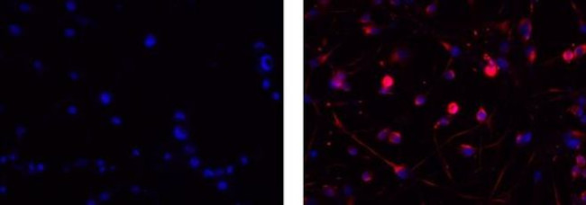 IgM Antibody in Immunocytochemistry (ICC/IF)