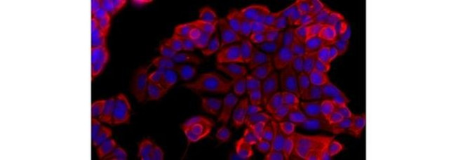 Pan Cytokeratin Antibody in Immunocytochemistry (ICC/IF)