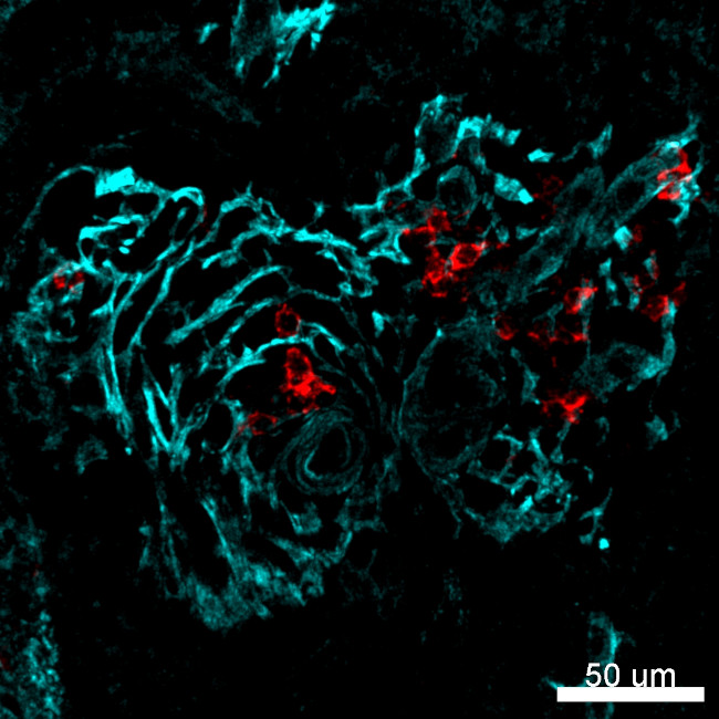 Alpha-Smooth Muscle Actin Antibody in Immunohistochemistry (IHC)