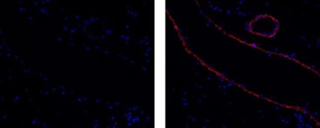 Alpha-Smooth Muscle Actin Antibody in Immunohistochemistry (Paraffin) (IHC (P))