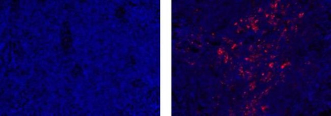 TRAF-1 Antibody in Immunohistochemistry (Paraffin) (IHC (P))