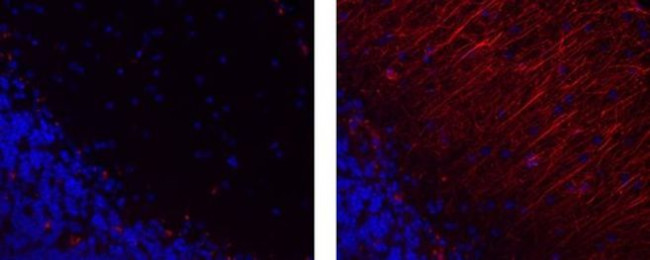 GFAP Antibody in Immunohistochemistry (Paraffin) (IHC (P))