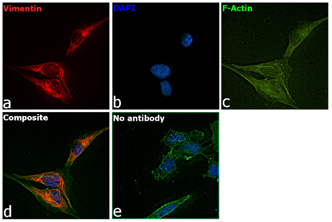 Vimentin Antibody in Immunocytochemistry (ICC/IF)