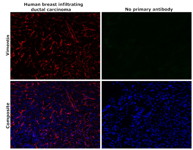 Vimentin Antibody in Immunohistochemistry (Paraffin) (IHC (P))