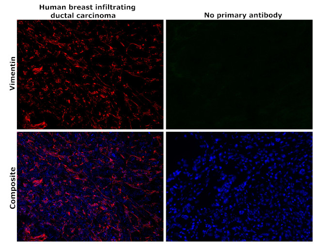 Vimentin Antibody in Immunohistochemistry (Paraffin) (IHC (P))