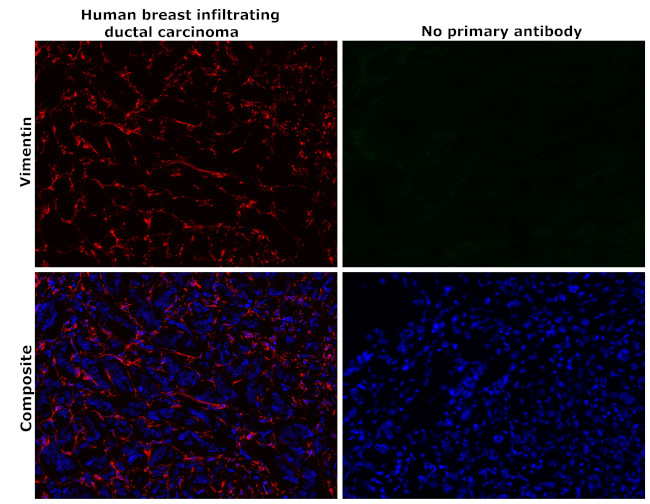 Vimentin Antibody in Immunohistochemistry (Paraffin) (IHC (P))