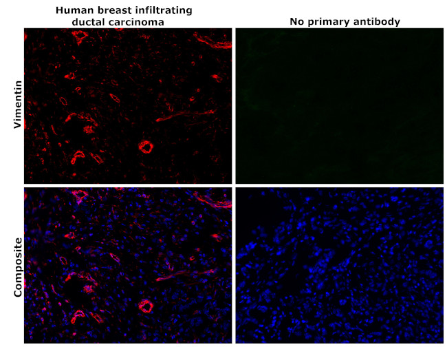 Vimentin Antibody in Immunohistochemistry (Paraffin) (IHC (P))