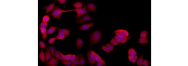 Cytokeratin 19 Antibody in Immunocytochemistry (ICC/IF)