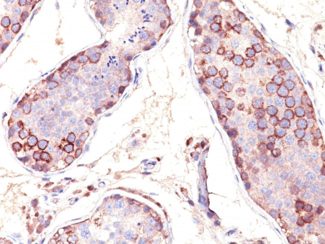 MAGE-1 (Target for Cancer Immunotherapy) Antibody in Immunohistochemistry (Paraffin) (IHC (P))