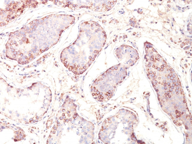 MAGE-1 (Target for Cancer Immunotherapy) Antibody in Immunohistochemistry (Paraffin) (IHC (P))
