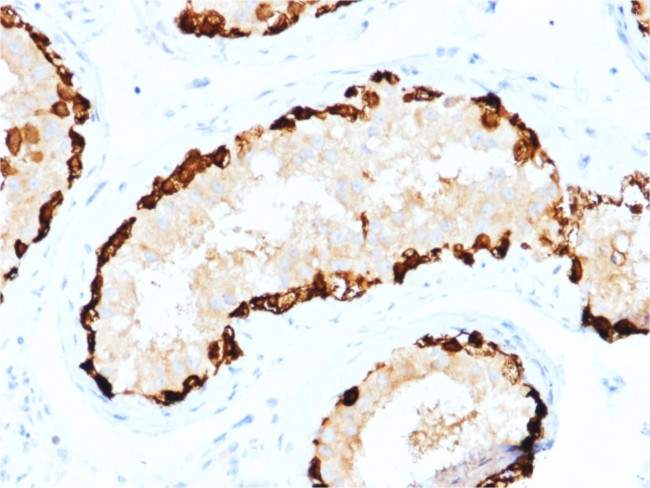 Melanoma Antigen Family A, 4/MAGEA4 Antibody in Immunohistochemistry (Paraffin) (IHC (P))