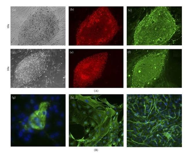 TRA-1-81 Antibody in Immunocytochemistry (ICC/IF)