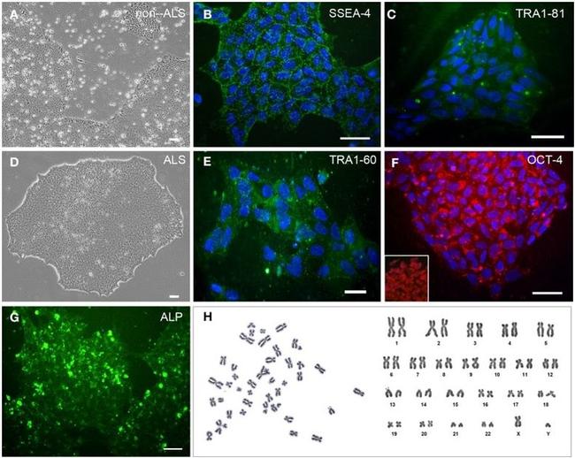 OCT4 Antibody in Immunocytochemistry (ICC/IF)