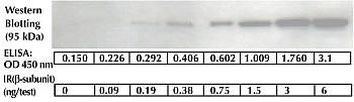 Human IR beta ELISA Kit