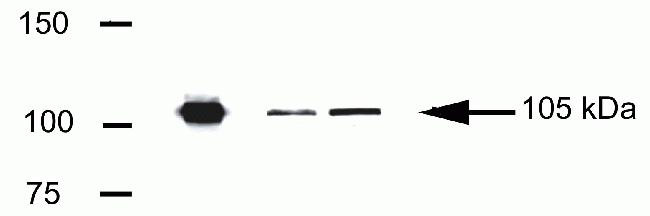 LSD1 Antibody in Western Blot (WB)