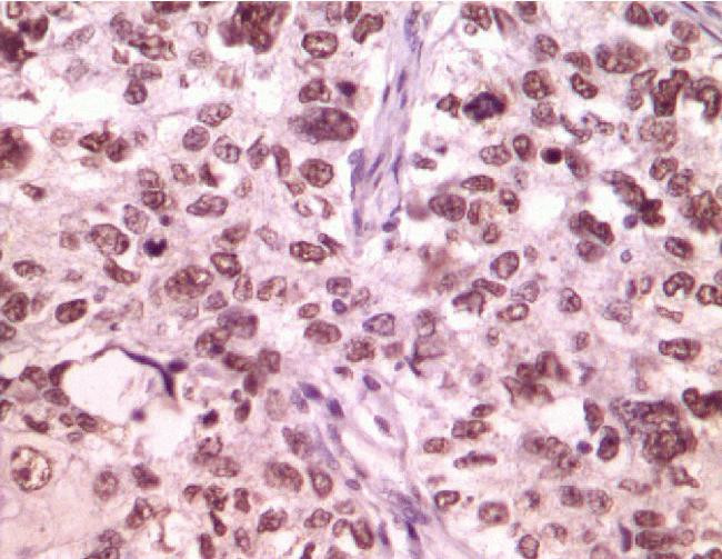 LSD1 Antibody in Immunohistochemistry (IHC)