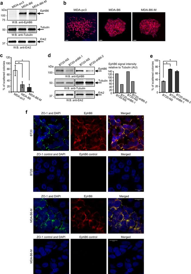 ZO-1 Antibody in Immunocytochemistry (ICC/IF)