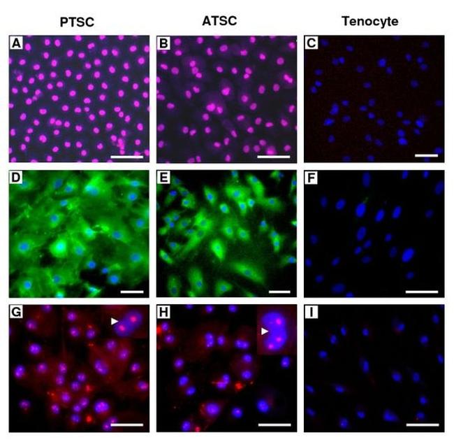 SSEA4 Antibody in Immunocytochemistry, Immunohistochemistry (ICC/IF, IHC)