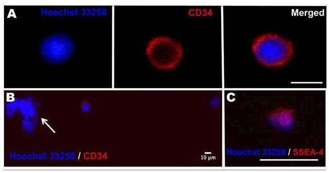 SSEA4 Antibody in Immunocytochemistry (ICC/IF)