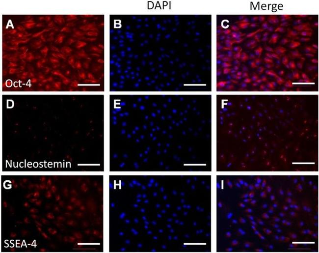 SSEA4 Antibody in Immunocytochemistry (ICC/IF)