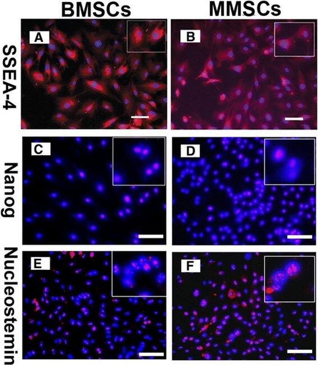 SSEA4 Antibody in Immunocytochemistry (ICC/IF)