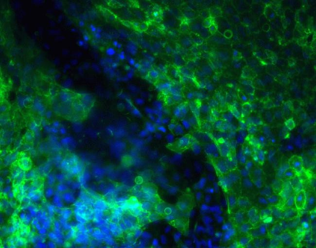 SSEA4 Antibody in Immunocytochemistry (ICC/IF)