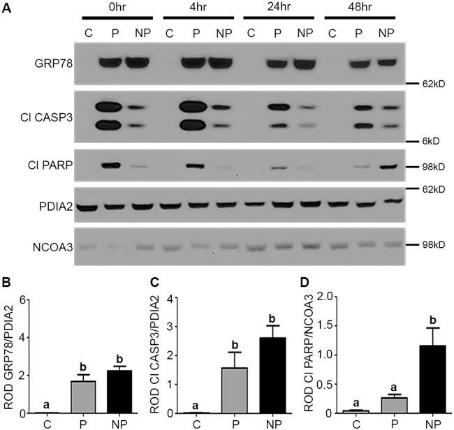 SRC3 Antibody in Western Blot (WB)