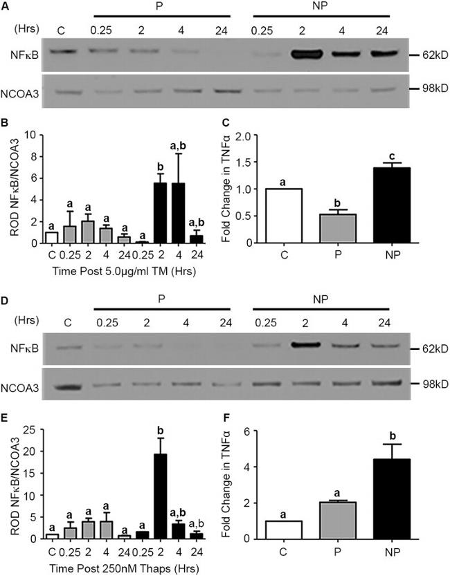 SRC3 Antibody in Western Blot (WB)