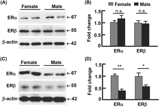 beta Actin Antibody in Western Blot (WB)