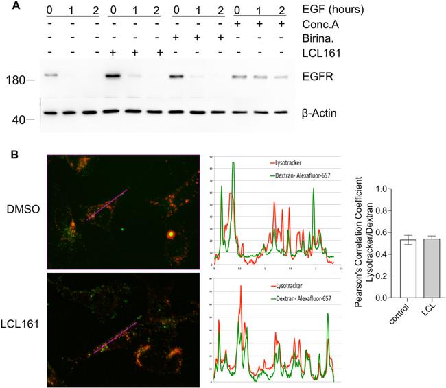 EGFR Antibody in Western Blot (WB)