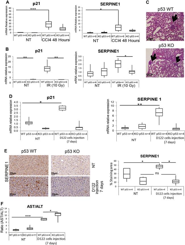 PAI1 Antibody in Immunohistochemistry (IHC)