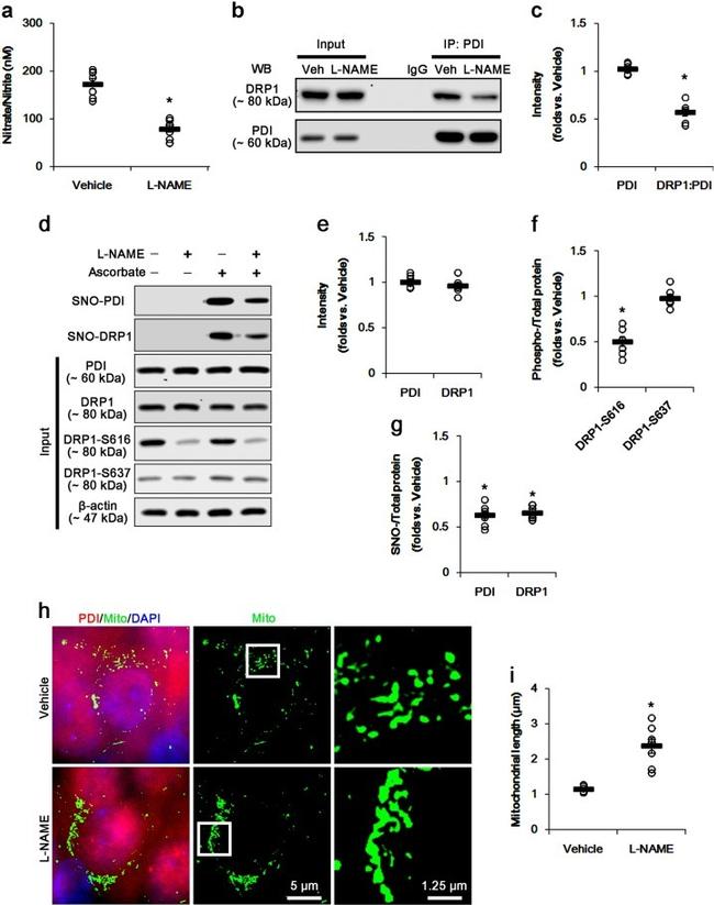 DNM1L Antibody in Western Blot (WB)