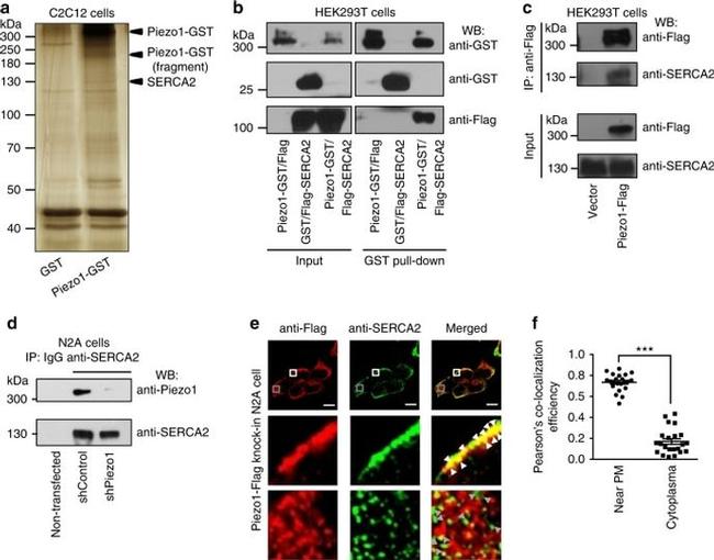 SERCA2 ATPase Antibody in Western Blot, Immunocytochemistry, Immunoprecipitation (WB, ICC/IF, IP)