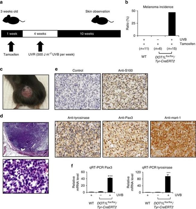 PAX3 Antibody in Immunohistochemistry (IHC)