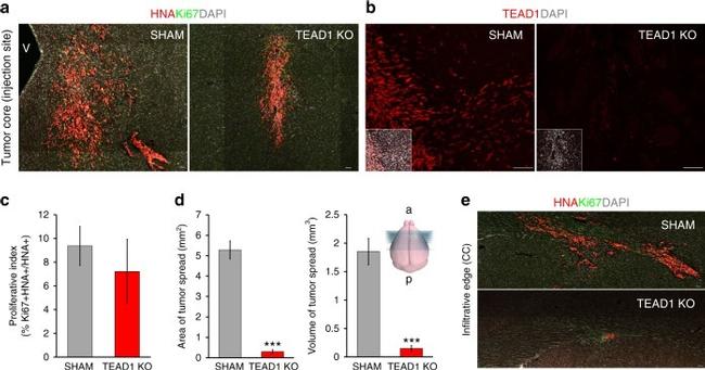 TEF1 Antibody in Immunohistochemistry (IHC)